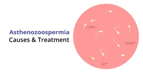 அஸ்தெனோசூஸ்பெர்மியா என்றால் என்ன