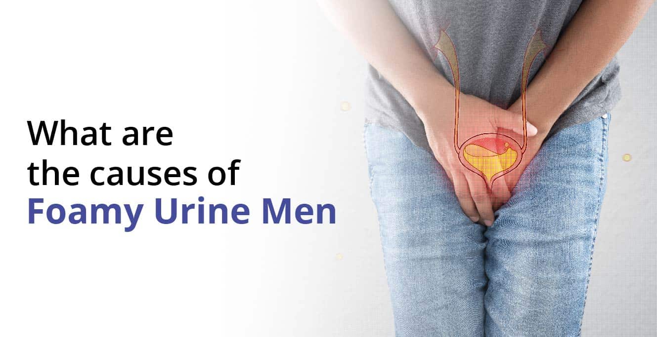 Foamy Urine in Men: Symptoms, Causes, Diagnosis & Treatment
