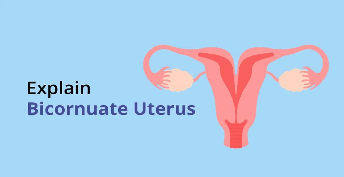Can a Bicornuate Uterus (Double Uterus) Affect Fertility?