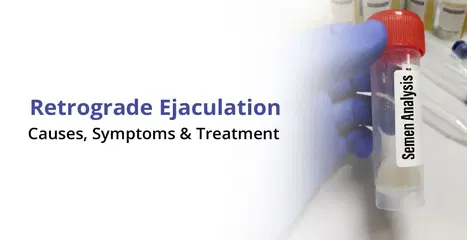 रेट्रोग्रेड इजॅक्युलेशन: कारणे, लक्षणे आणि उपचार