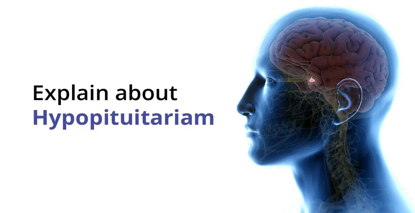 హైపోపిట్యూటరిజం లక్షణాలు, కారణాలు & దాని చికిత్స