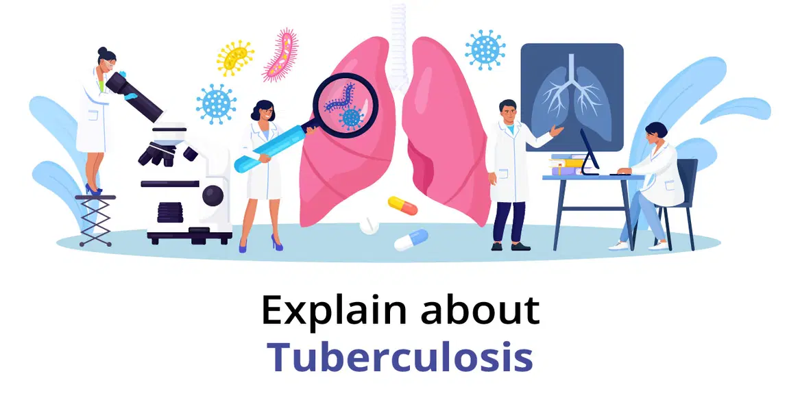 Tuberculosis: Causes, Symptoms, Treatment & Prevention