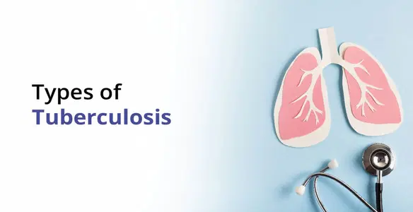 Types of Tuberculosis