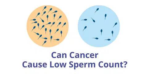 క్యాన్సర్ తక్కువ స్పెర్మ్ కౌంట్ కారణం కావచ్చు?