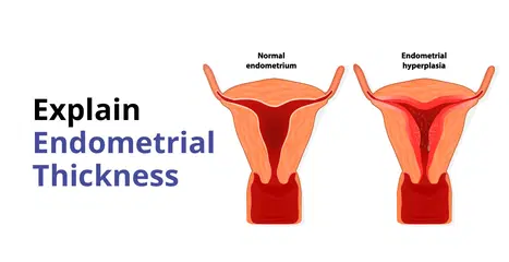 What is Endometrial Thickness? How is it Measured?