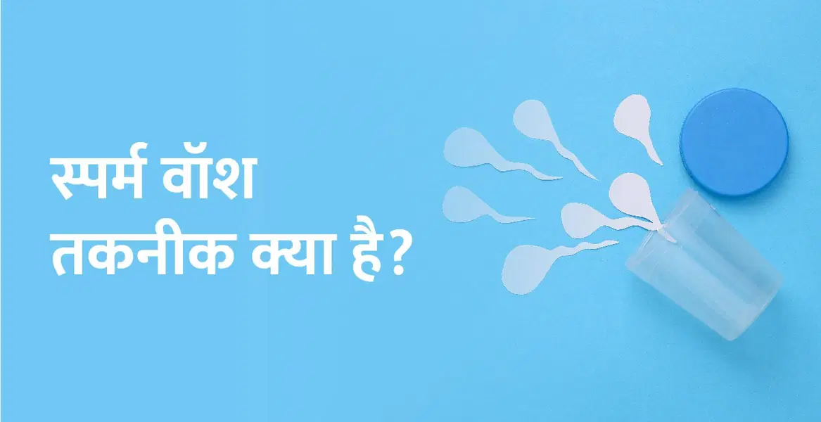 स्पर्म वॉश तकनीक क्या है? – Sperm Wash Technique in Hindi