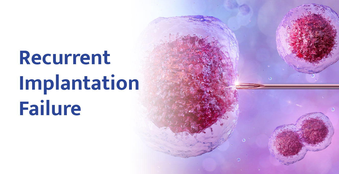 ಮರುಕಳಿಸುವ ಇಂಪ್ಲಾಂಟೇಶನ್ ವೈಫಲ್ಯ – ಏನು ಮಾಡಬೇಕು?