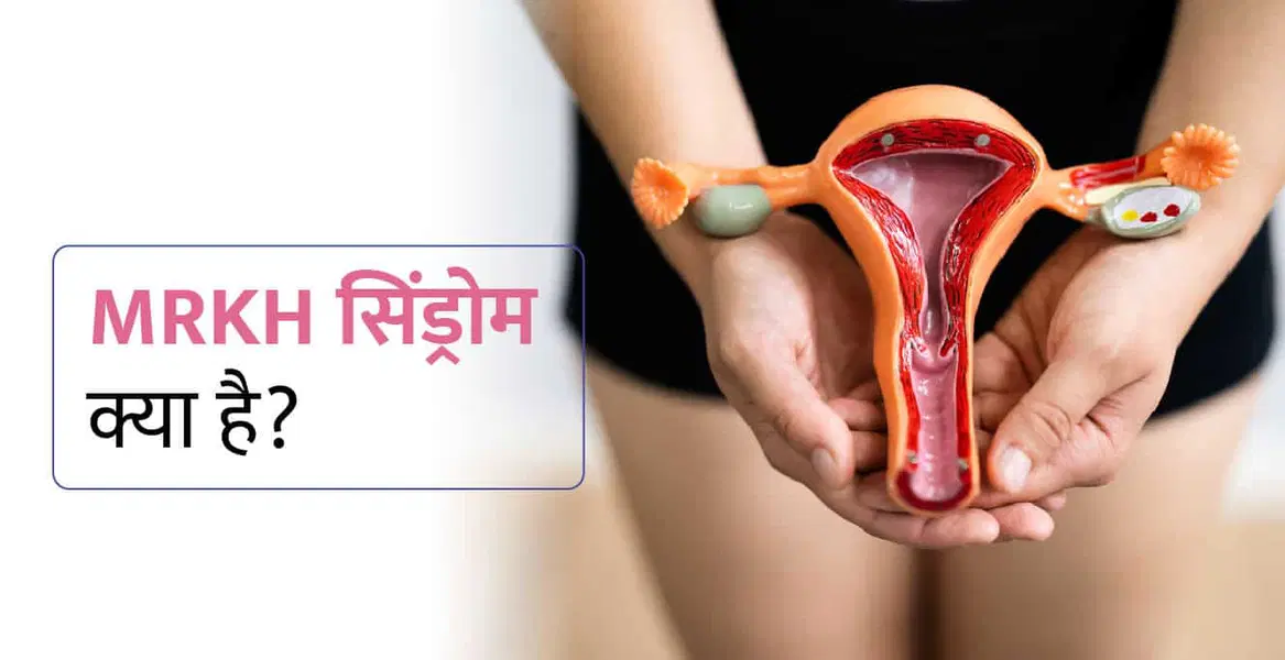 MRKH Syndrome in Hindi – एमआरकेएच सिंड्रोम क्या है? कारण, लक्षण और उपचार