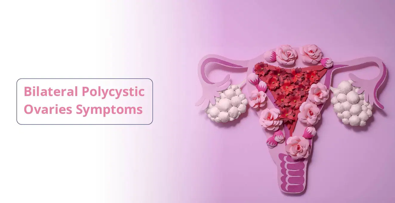 ద్వైపాక్షిక PCOS: కారణాలు, లక్షణాలు మరియు చికిత్స