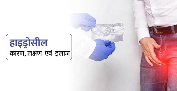 हाइड्रोसील (Hydrocele in Hindi): कारण, लक्षण और इलाज की पूरी जानकारी