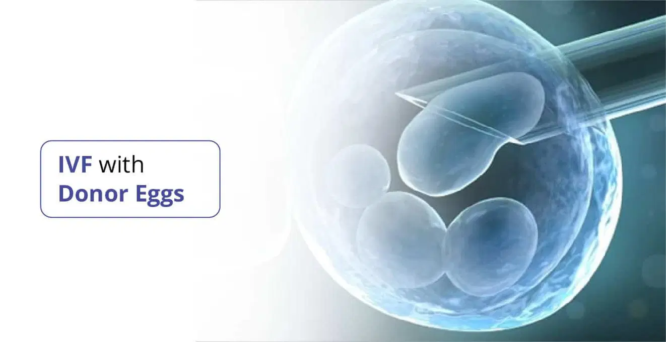 દાતા ઇંડા સાથે IVF: તમારી તકો શું છે?